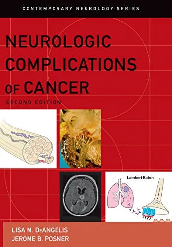 Neurologic Complications of Cancer (Contemporary Neurology Series Book 73), 2nd edition (Original PDF from Publisher)