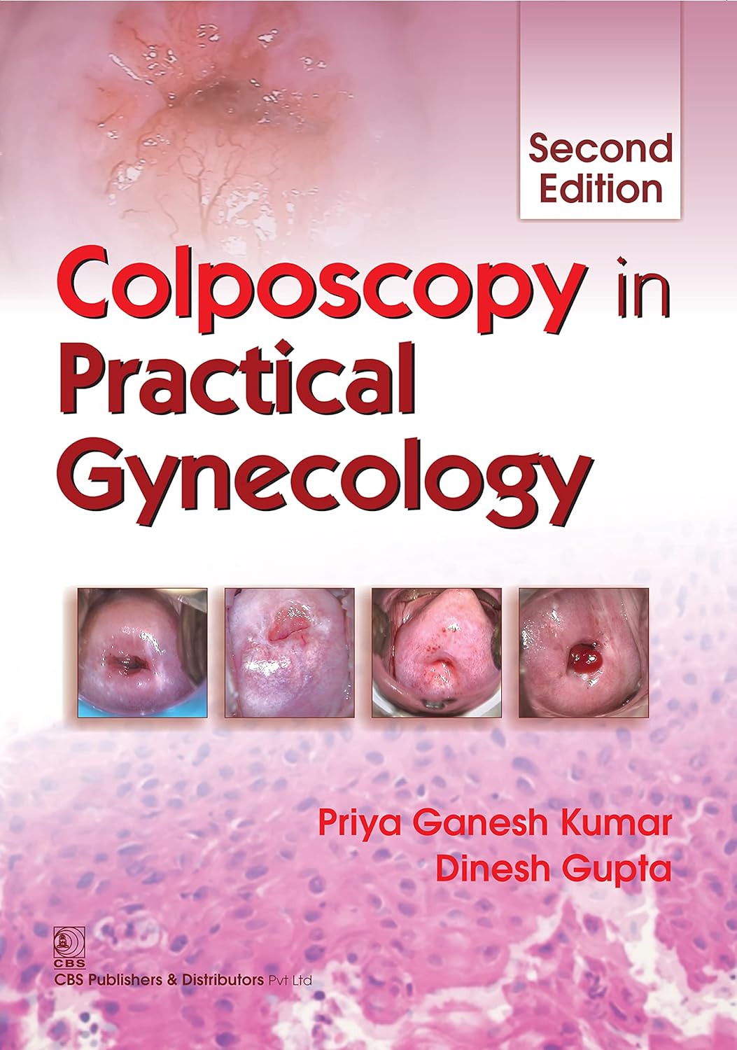 Colposcopy in Practical Gynaecology (Original PDF from Publisher)