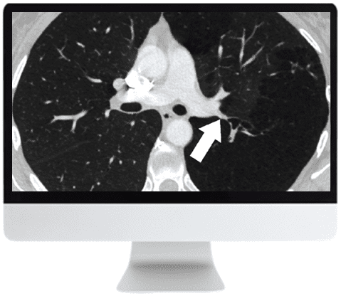 ARRS Basic Chest Imaging 2019 ( VIDEOS)