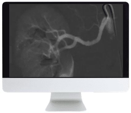 ARRS Case-Based Subspecialty Review 2021