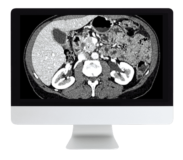 ARRS Gastrointestinal Imaging Online Course 2019 ( VIDEOS)