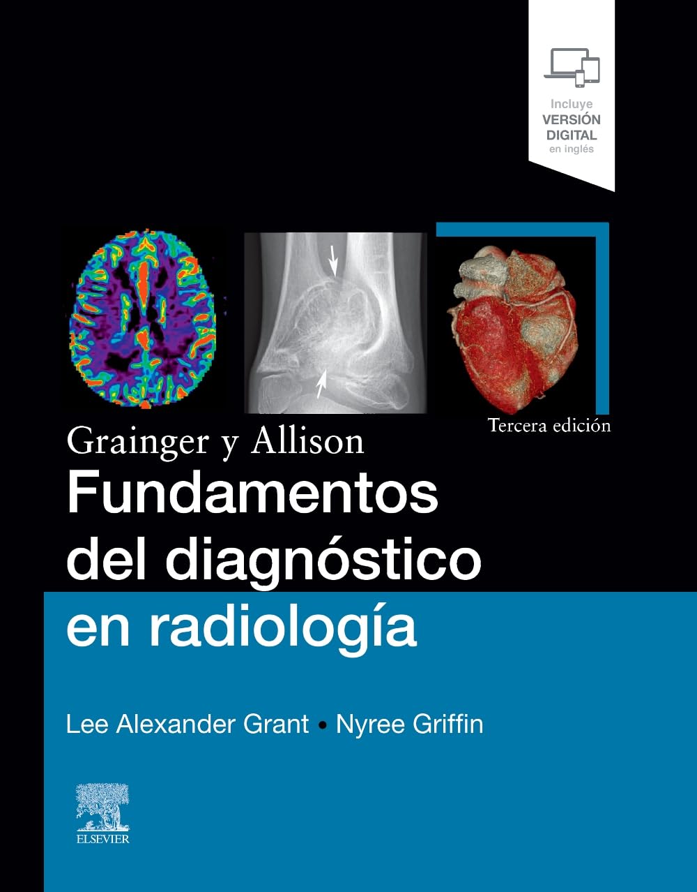 Grainger y Allison. Fundamentos del diagnóstico en radiología, 3rd Edition (Original PDF from Publisher)