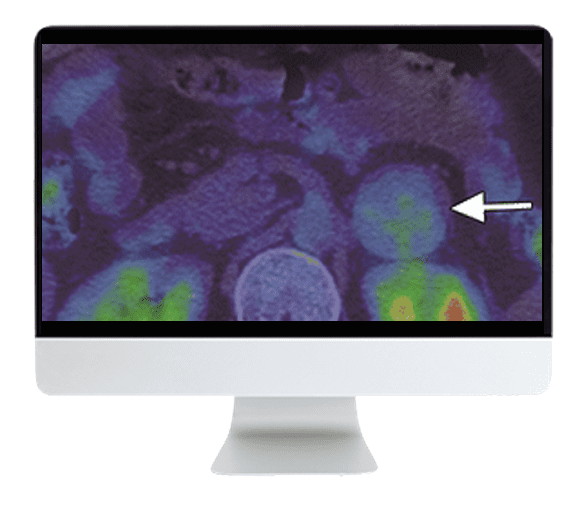 ARRS Breakthroughs in Nuclear Medicine for Neurology and Oncology 2021 ( VIDEOS)