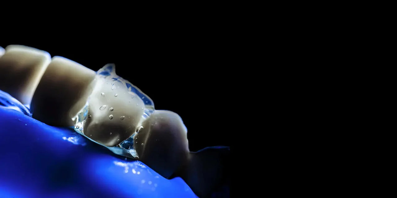 OHI-S Occlusion-driven stress-reduced direct composite (SRDC)