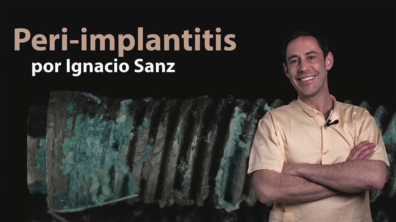 Osteocom Peri-implantitis by Ignacio Sanz Spanish