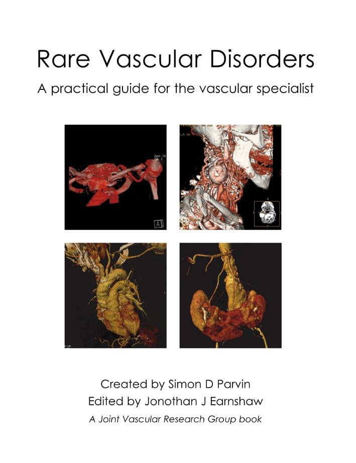 Rare Vascular Disorders: A practical guide for the vascular specialist (Original PDF from Publisher)