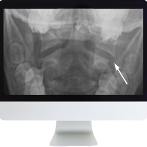 Neuroradiology Review for the Practicing Radiologist 2018