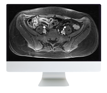 ARRS A Guide to Bowel Imaging 2019 (CME VIDEOS)