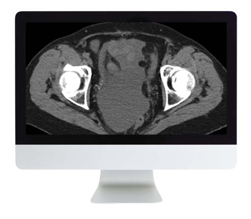 Radiologic Reasoning: A Rapid-Fire Multispecialty Review 2018 (ARRS VIDEOS) (CME VIDEOS)