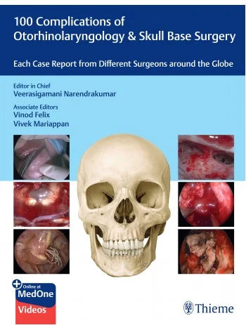 100 Complications of Otorhinolaryngology & Skull Base Surgery (Original PDF from Publisher+Videos)