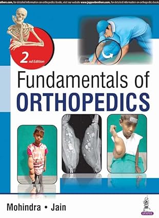 Fundamentals of Orthopedics