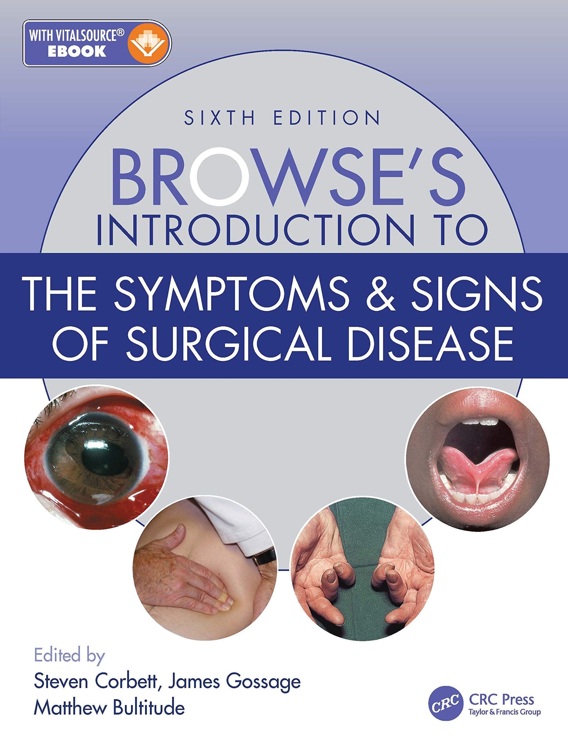 Browse’s Introduction to the Symptoms & Signs of Surgical Disease 6th Edition