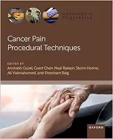 Cancer Pain Procedural Techniques (Anesthesia Illustrated) (Original PDF from Publisher)