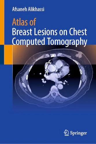 Atlas of Breast Lesions on Chest Computed Tomography (Original PDF from Publisher)