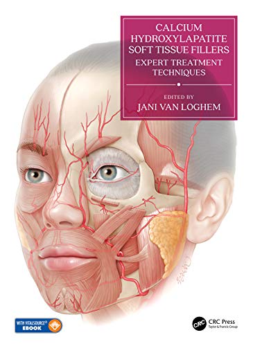 Calcium Hydroxylapatite Soft Tissue Fillers: Expert Treatment Techniques (Videos)