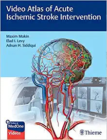 Video Atlas of Acute Ischemic Stroke Intervention (EPUB)