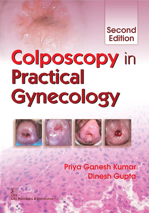 Colposcopy in Practical Gynaecology (Original PDF from Publisher)