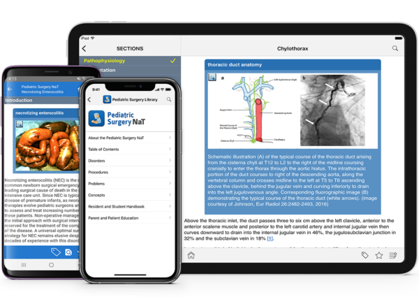 APSA Pediatric Surgery Library