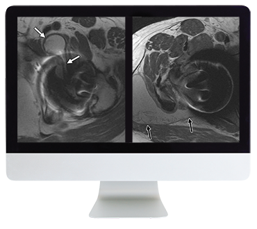 ARRS Controversies In Hip And Pelvis Imaging 2016 (CME VIDEOS)
