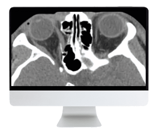 ARRS Imaging Victims of Violence: Fists, Stabs, Bullets, and Blasts 2021 (CME VIDEOS)
