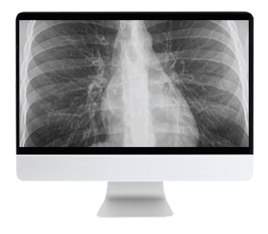 ARRS Cranial Nerve Imaging: From the Least to the Last 2022 ( Videos )