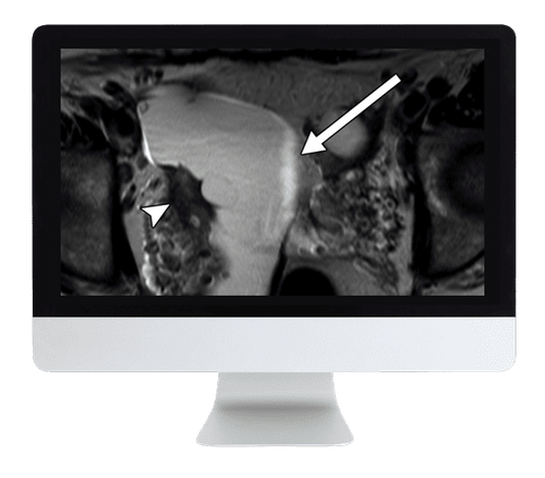 ARRS Pitfalls in GI Imaging 2022