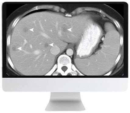 ARRS SAR Disease-Focused Panels: Cancer Imaging and Reporting Guidelines 2021 ( VIDEOS)