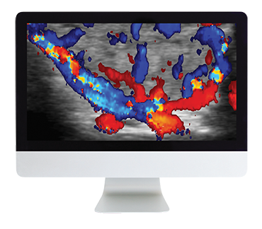 ARRS Thyroid Imaging 2019 ( VIDEOS)