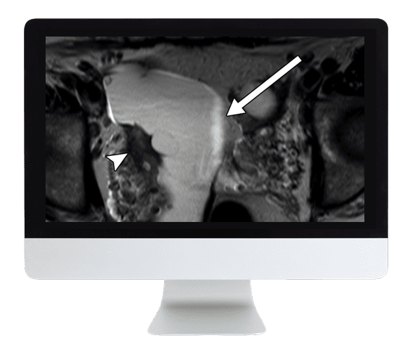 ARRS Women’s Imaging 2019 (CME VIDEOS)