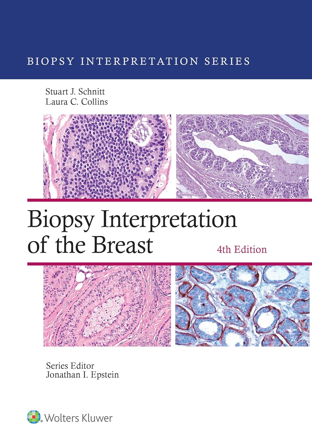 Biopsy Interpretation of the Breast (Biopsy Interpretation Series), 4th Edition (EPUB and pdf)