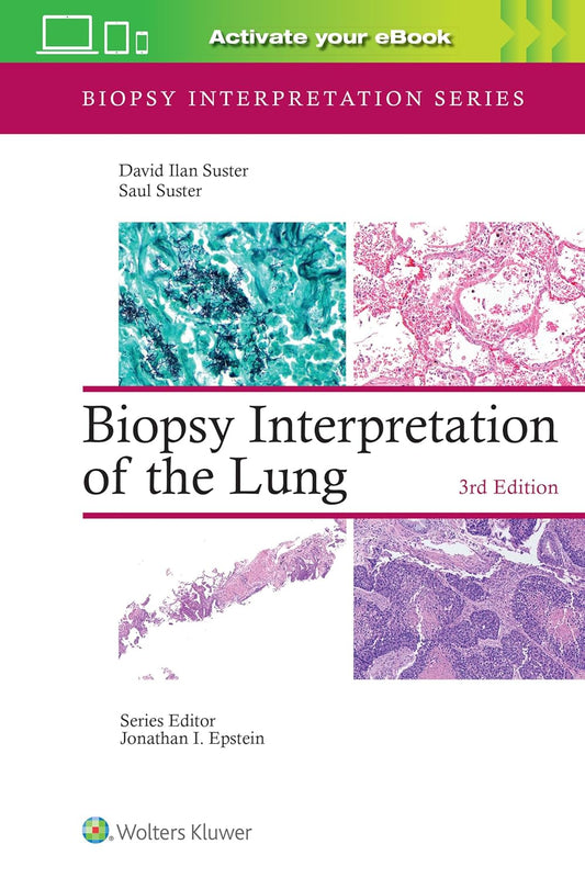 Biopsy Interpretation of the Lung (Biopsy Interpretation Series) (EPUB and pdf)
