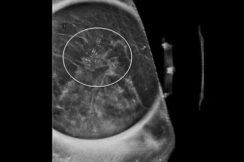 CHEST Board Review On Demand 2025 : Sleep Medicine (Videos+Audios+Pdfs+Pre and Post exams)