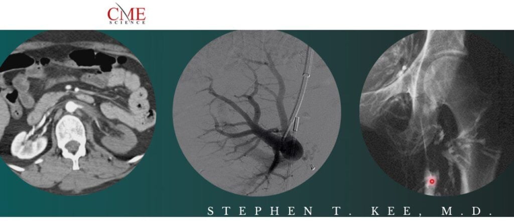 Science Interventional Radiology Stephen T. Kee, M.D 2021