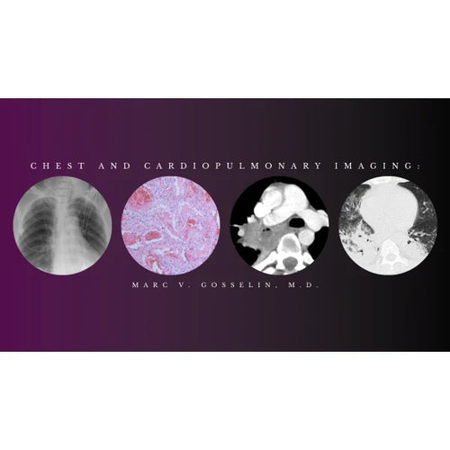 CMEScience Chest and Cardiopulmonary Imaging – Marc V. Gosselin, M.D (Videos + PDF)