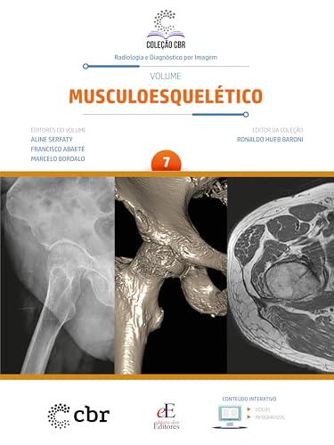 Coleção CBR Volume 7 – Musculoesquelético (Portuguese Edition) (EPUB)