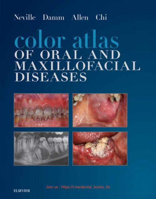 Color Atlas of Oral and Maxillofacial Diseases
