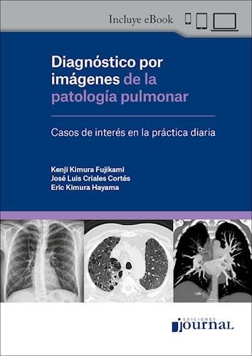 Diagnóstico por Imágenes de la Patología Pulmonar. Casos de Interés en la Práctica Diaria (Original PDF from Publisher)