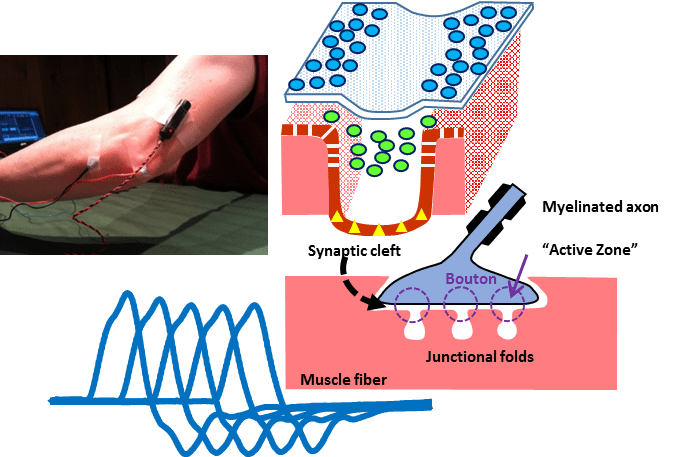 EMG/NCS Online Series: Volume XII Repetitive Nerve Stimulation