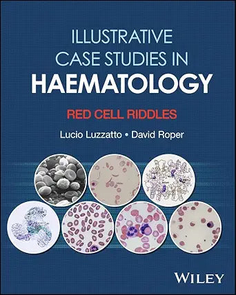 Illustrative Case Studies in Haematology: Red Cell Riddles (Original PDF from Publisher)