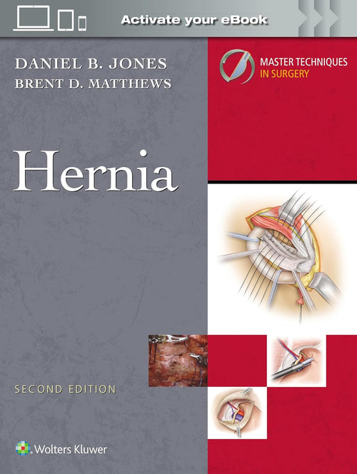 Master Techniques in Surgery: Hernia, 2nd Edition (EPUB)