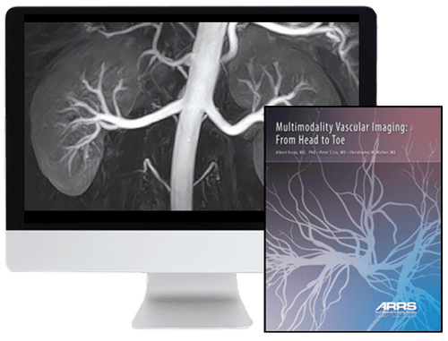 Multimodality Vascular Imaging: From Head to Toe 2020