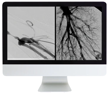 ARRS Case Review of Vascular and Interventional Radiology 2023 (Videos)