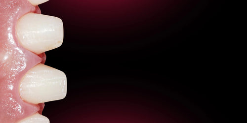 OHI-S Aesthetic Dentistry Online Congress