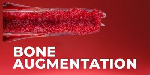 OHI-S Bone Augmentation Current Techniques