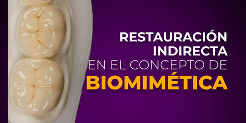 OHI-S Restauración indirecta en el concepto de biomimética Spanish