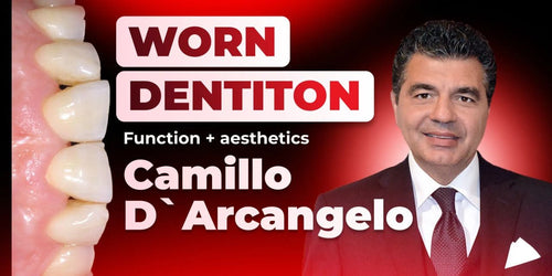 OHI-S Treatment of pathological tooth wear. Additive prosthodontics. The concept Aesthetics-Function-Posture