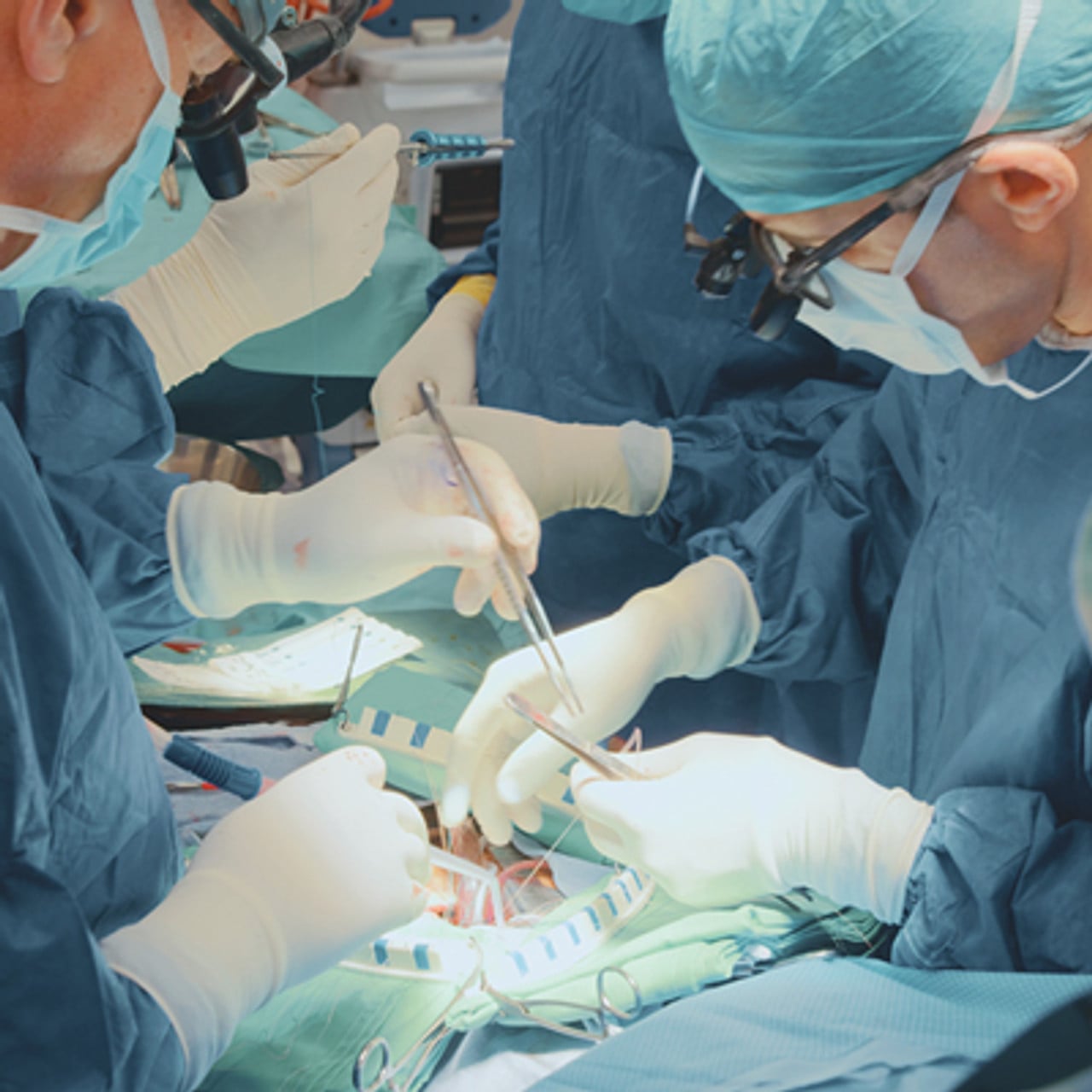 Oakstone Comprehensive Review of Cardiac Surgery 2025