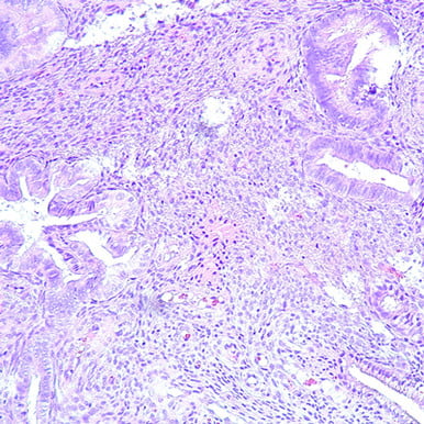 Oakstone Gynecologic Pathology 2026