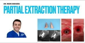 Partial Extraction Therapy Course