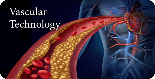 Pegasus Vascular Technology Review 2022